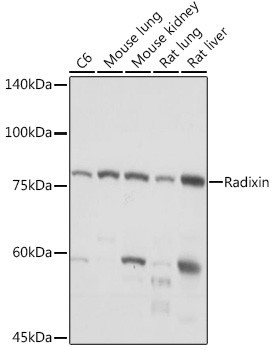 Radixin Antibody in Western Blot (WB)