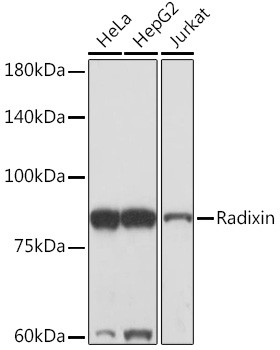 Radixin Antibody in Western Blot (WB)