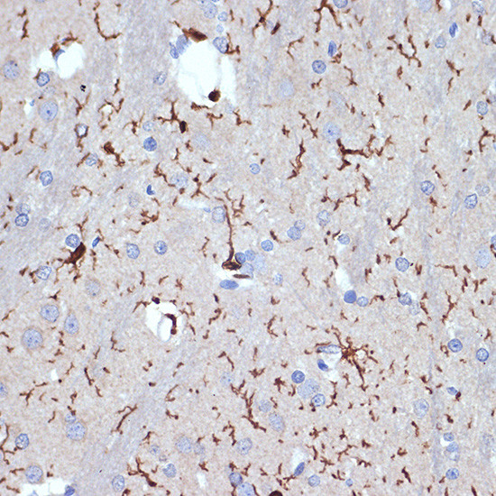 IBA1 Antibody in Immunohistochemistry (Paraffin) (IHC (P))