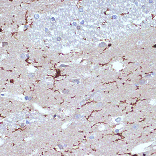 IBA1 Antibody in Immunohistochemistry (Paraffin) (IHC (P))