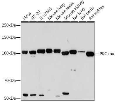 PKC mu Antibody in Western Blot (WB)