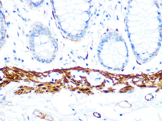 Calponin 1 Antibody in Immunohistochemistry (Paraffin) (IHC (P))