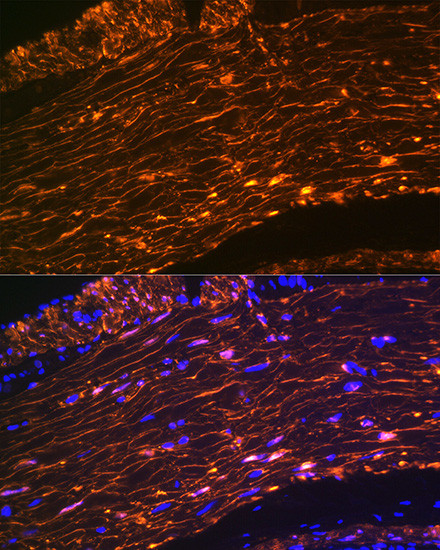 Calponin 1 Antibody in Immunohistochemistry (Paraffin) (IHC (P))