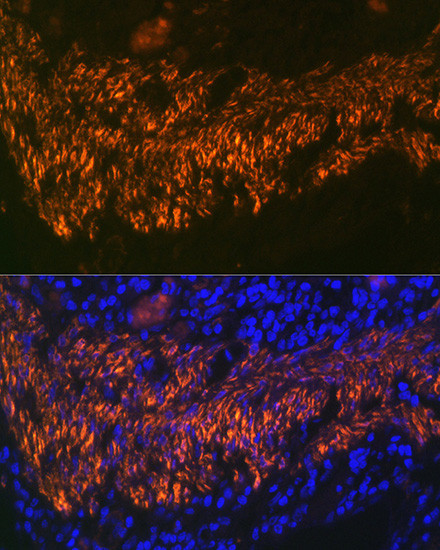 Calponin 1 Antibody in Immunohistochemistry (Paraffin) (IHC (P))