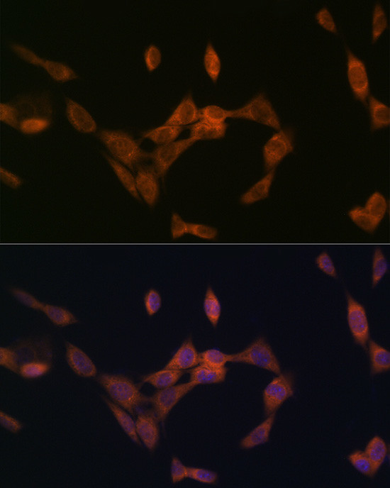 PMP70 Recombinant Monoclonal Antibody (ARC2131) (MA5-38109)