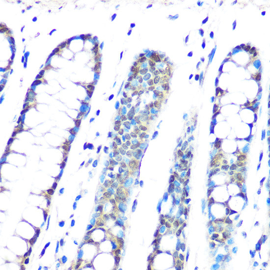 HP1 gamma Antibody in Immunohistochemistry (Paraffin) (IHC (P))