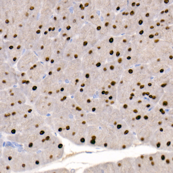 GATA4 Antibody in Immunohistochemistry (Paraffin) (IHC (P))