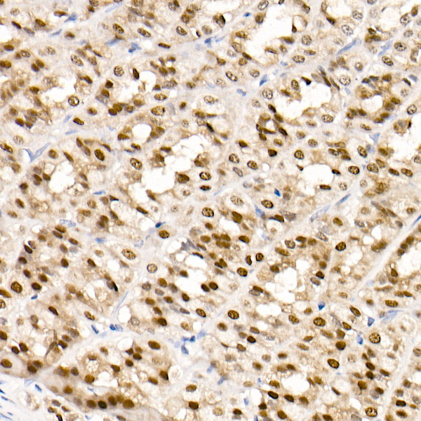 GATA4 Antibody in Immunohistochemistry (Paraffin) (IHC (P))