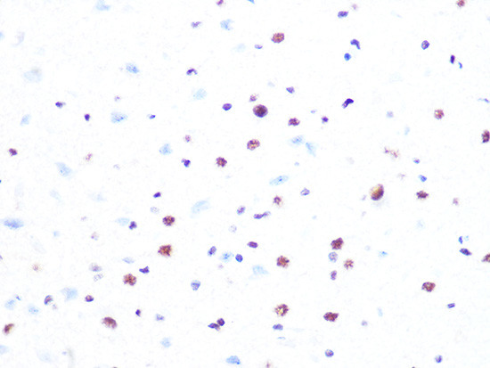 PRP8 Antibody in Immunohistochemistry (Paraffin) (IHC (P))