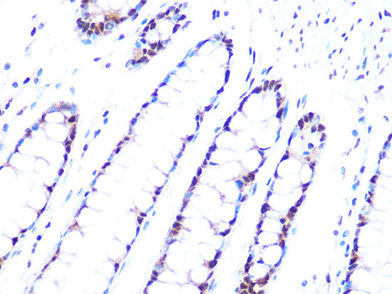 PRP8 Antibody in Immunohistochemistry (Paraffin) (IHC (P))