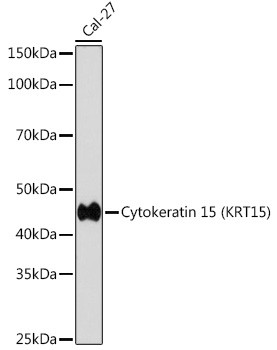 Cytokeratin 15 Antibody in Western Blot (WB)