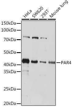 PAR4 Antibody in Western Blot (WB)