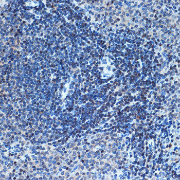 CHD3 Antibody in Immunohistochemistry (Paraffin) (IHC (P))