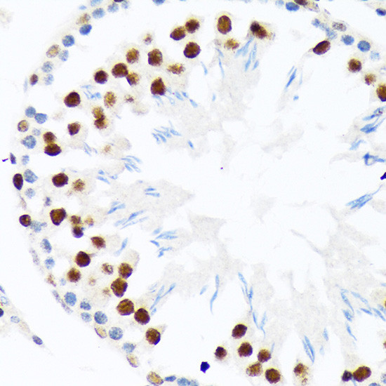 PIAS1/PIAS2 Antibody in Immunohistochemistry (Paraffin) (IHC (P))