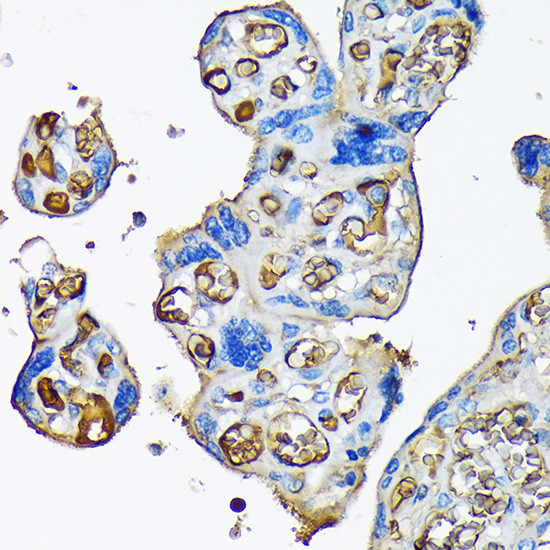 A2M Antibody in Immunohistochemistry (Paraffin) (IHC (P))