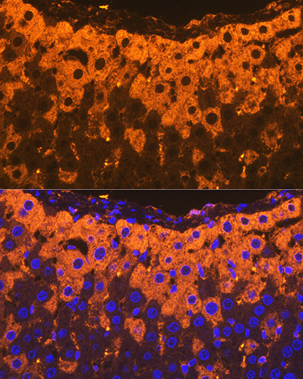 A2M Antibody in Immunohistochemistry (Paraffin) (IHC (P))