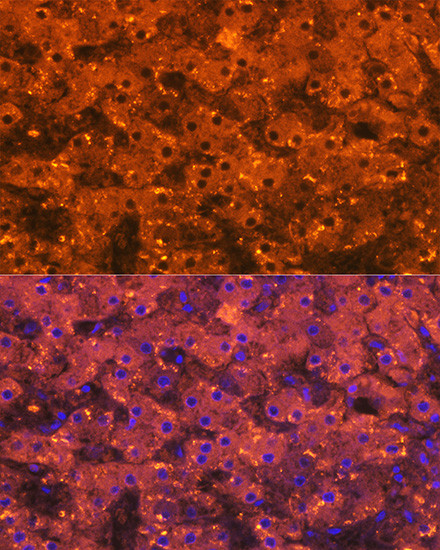 A2M Antibody in Immunohistochemistry (Paraffin) (IHC (P))