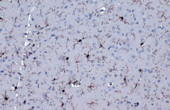 IBA1 Antibody in Immunohistochemistry (Paraffin) (IHC (P))