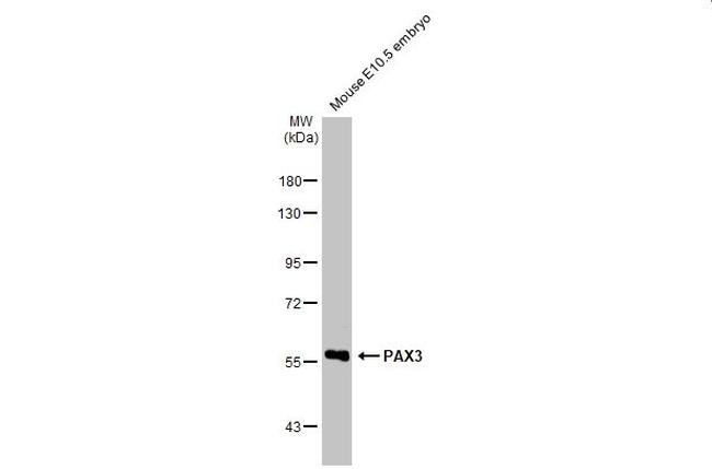 PAX3 Antibody in Western Blot (WB)