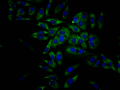 eIF4A1 Antibody in Immunocytochemistry (ICC/IF)