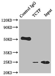 TPT1 Antibody in Immunoprecipitation (IP)