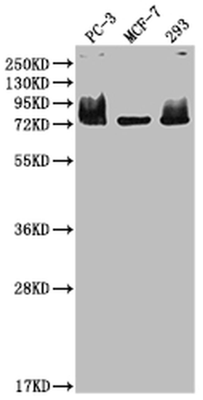 Menin Antibody in Western Blot (WB)