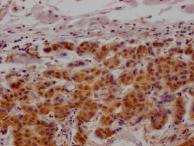 MAPKAPK2 Antibody in Immunohistochemistry (Paraffin) (IHC (P))