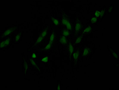 NUP98 Antibody in Immunocytochemistry (ICC/IF)