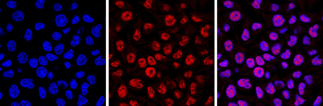 5-Methylcytosine Monoclonal Antibody (33D3) (MA5-38432)