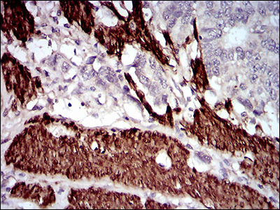 Calponin 1 Antibody in Immunohistochemistry (Paraffin) (IHC (P))