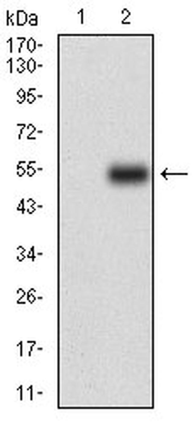 CSF1R Antibody in Western Blot (WB)