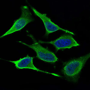 DNM1L Antibody in Immunocytochemistry (ICC/IF)