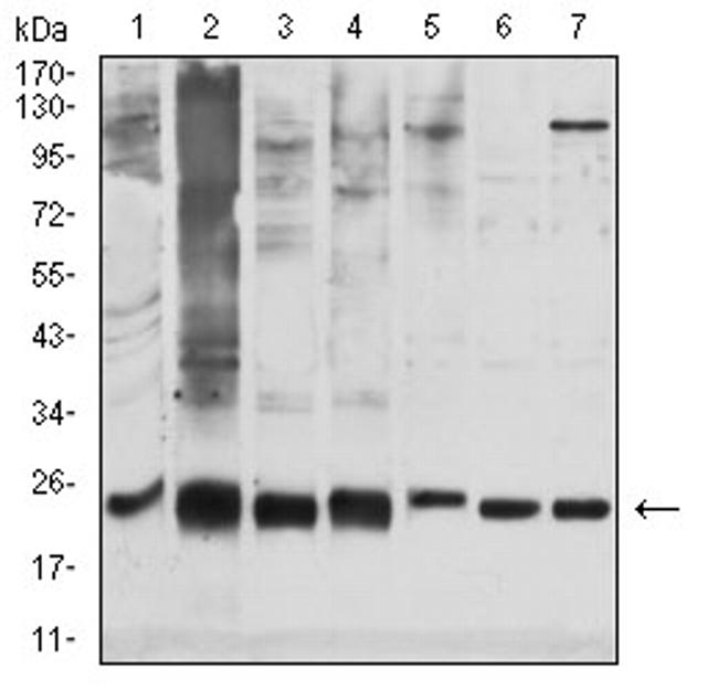 GSTP1 Antibody in Western Blot (WB)