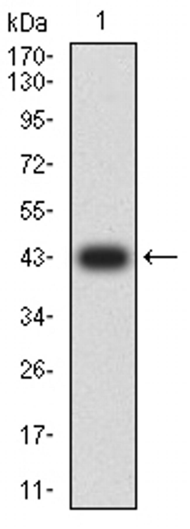 HRX Antibody in Western Blot (WB)