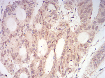 MEK3 Antibody in Immunohistochemistry (Paraffin) (IHC (P))