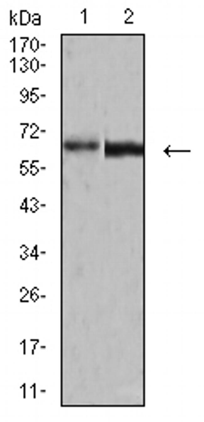Human Parvovirus VP2 Antibody in Western Blot (WB)