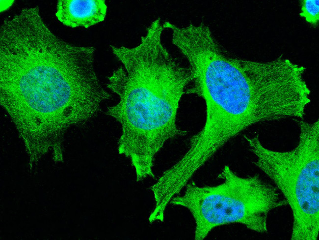 ADSL Antibody in Immunocytochemistry (ICC/IF)