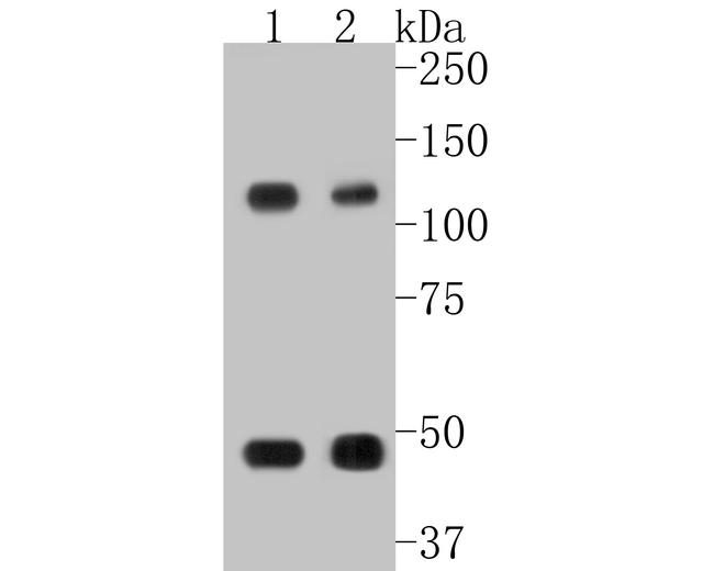NFkB p50/p105 Antibody in Western Blot (WB)