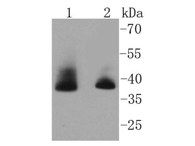 Aurora B Antibody in Western Blot (WB)