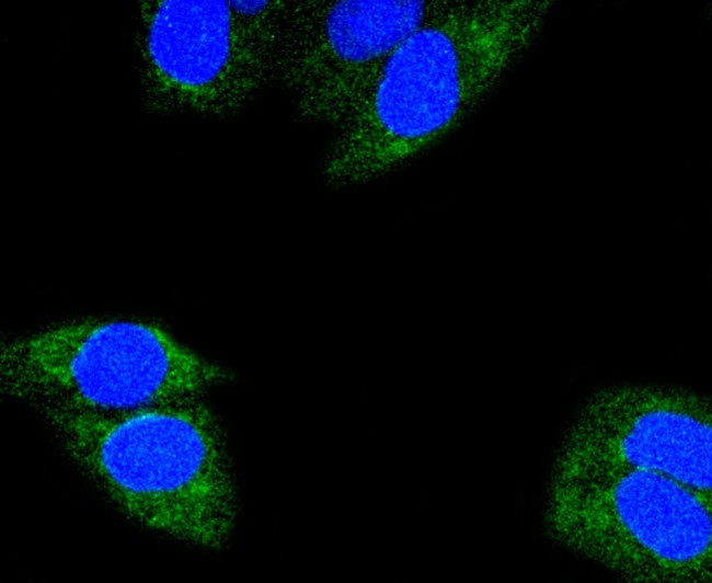 Glutaminase Antibody in Immunocytochemistry (ICC/IF)