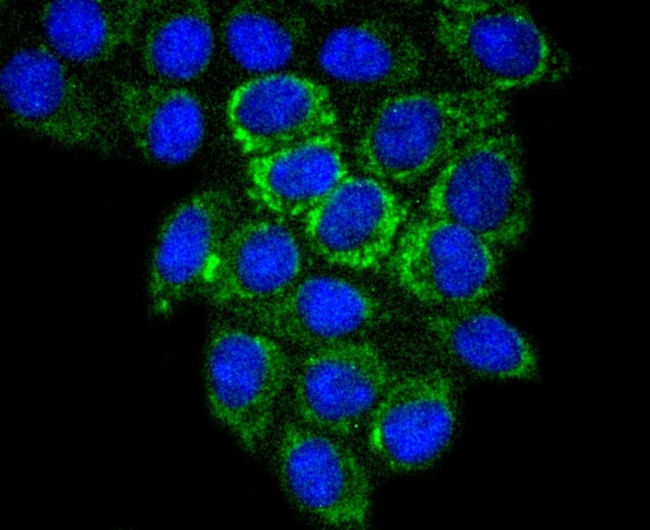 Glutaminase Antibody in Immunocytochemistry (ICC/IF)