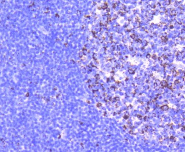 Glutaminase Antibody in Immunohistochemistry (Paraffin) (IHC (P))