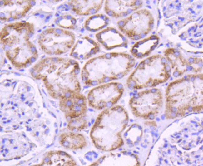 Glutaminase Antibody in Immunohistochemistry (Paraffin) (IHC (P))