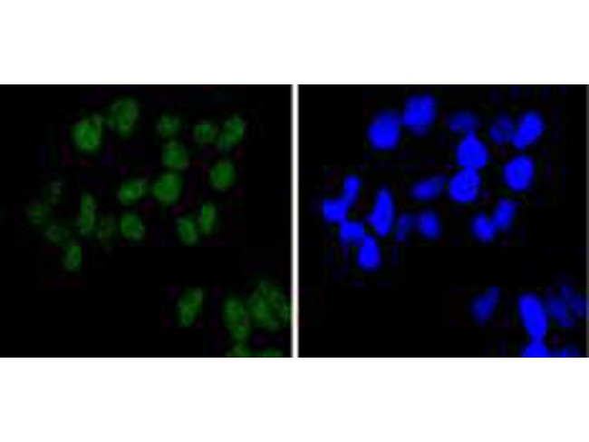 BRG1 Antibody in Immunocytochemistry (ICC/IF)