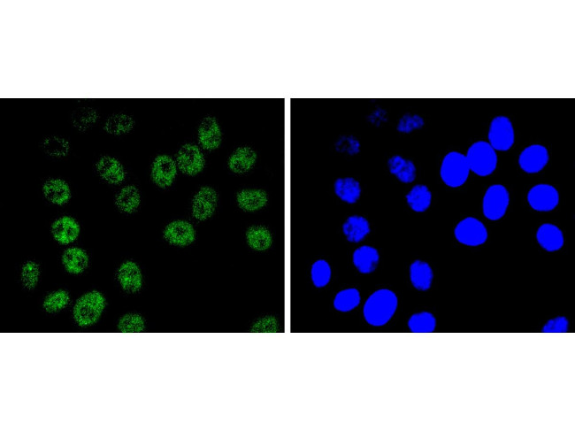 BRG1 Antibody in Immunocytochemistry (ICC/IF)