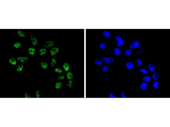 BRG1 Antibody in Immunocytochemistry (ICC/IF)