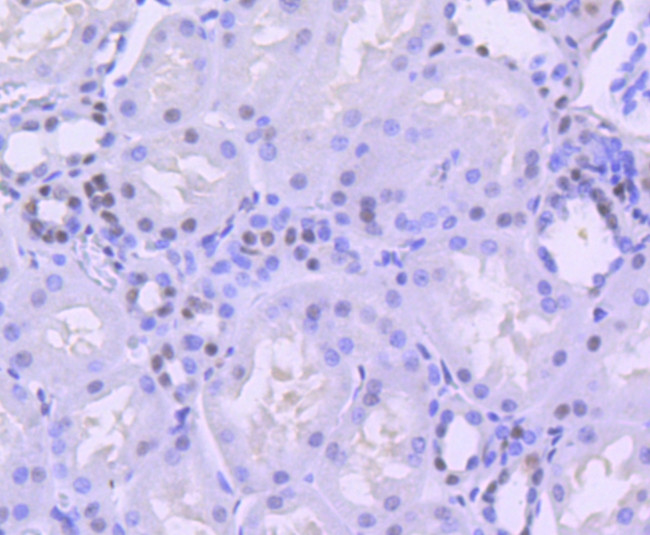 BRG1 Antibody in Immunohistochemistry (Paraffin) (IHC (P))