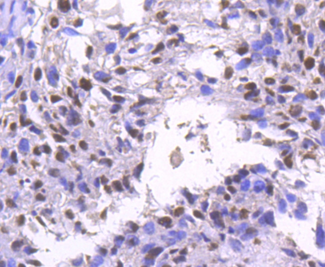 BRG1 Antibody in Immunohistochemistry (Paraffin) (IHC (P))