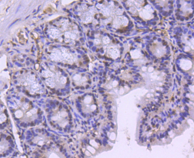 BRG1 Antibody in Immunohistochemistry (Paraffin) (IHC (P))