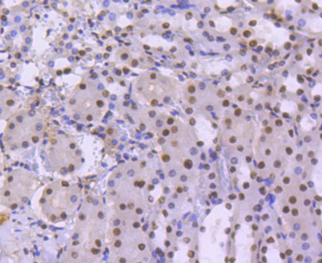 BRG1 Antibody in Immunohistochemistry (Paraffin) (IHC (P))